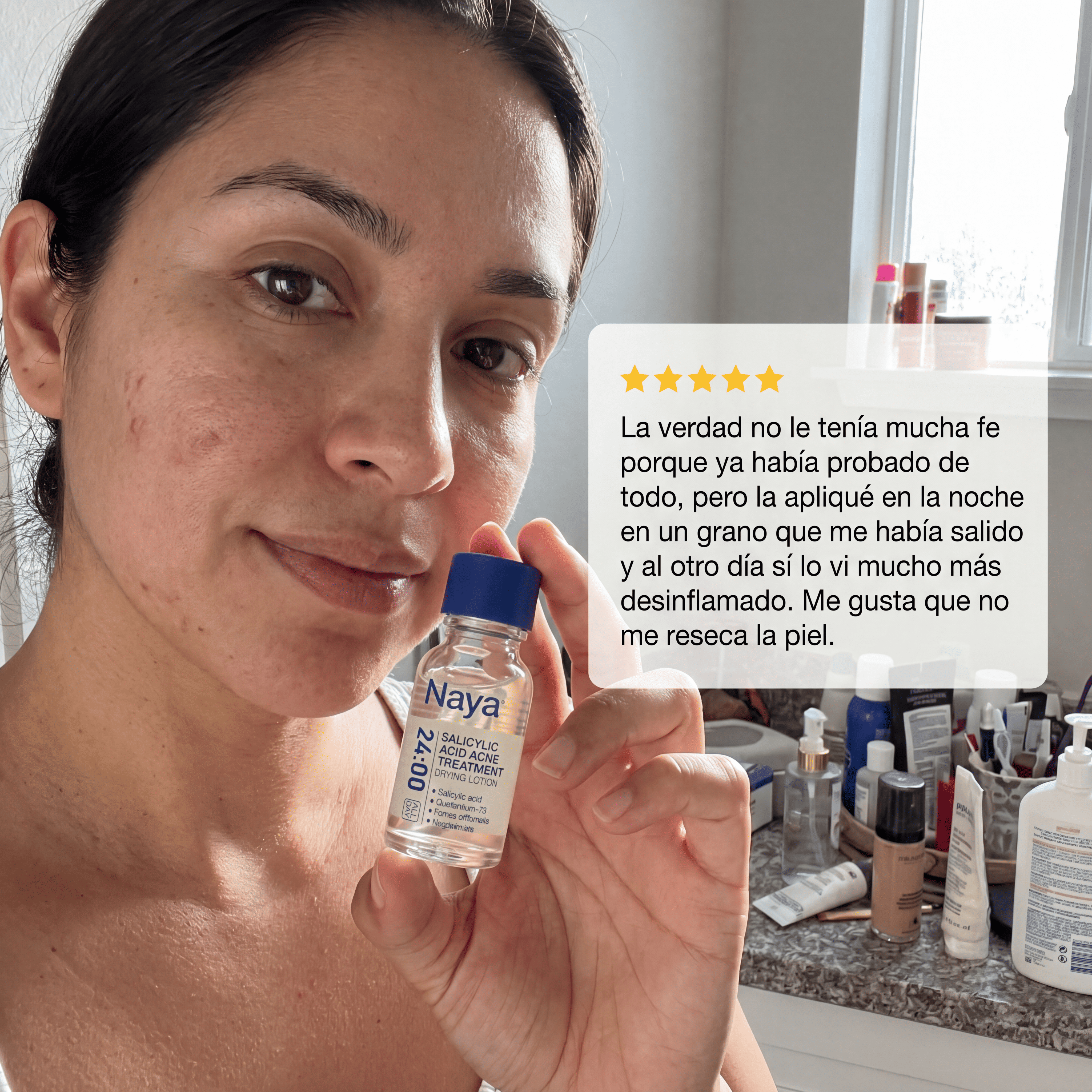 Naya® Loción Secante Anti-Acné